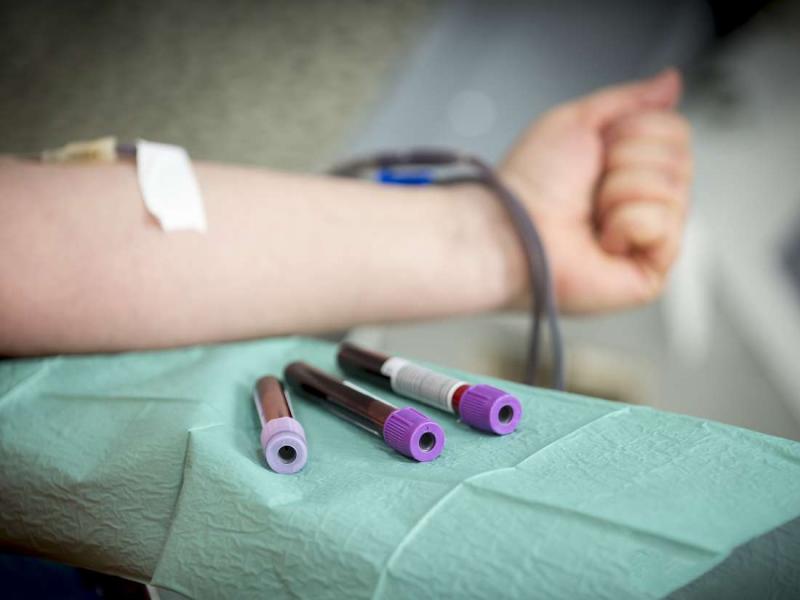 A1C testi nedir? Nasıl kullanılır?