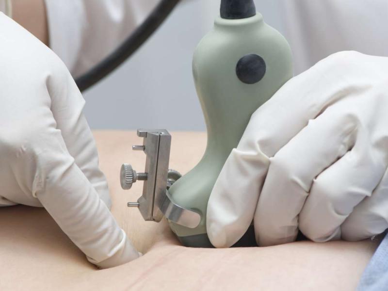 Amniyosentez hakkında bilmeniz gerekenler