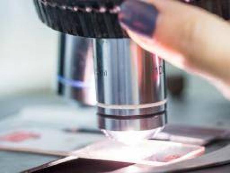 Biyopsi nedir? Biyopsi hangi durumlarda kullanılır?