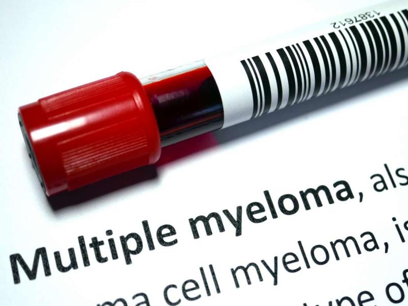 Multipl miyelomun belirtileri nelerdir?