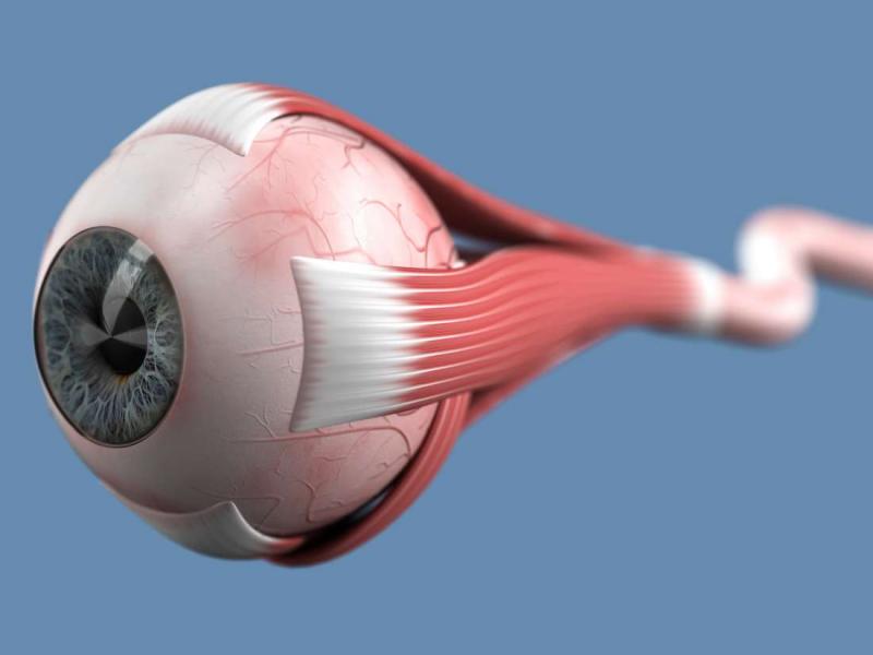 Optik nörit belirtileri, tedavisi ve nedenleri