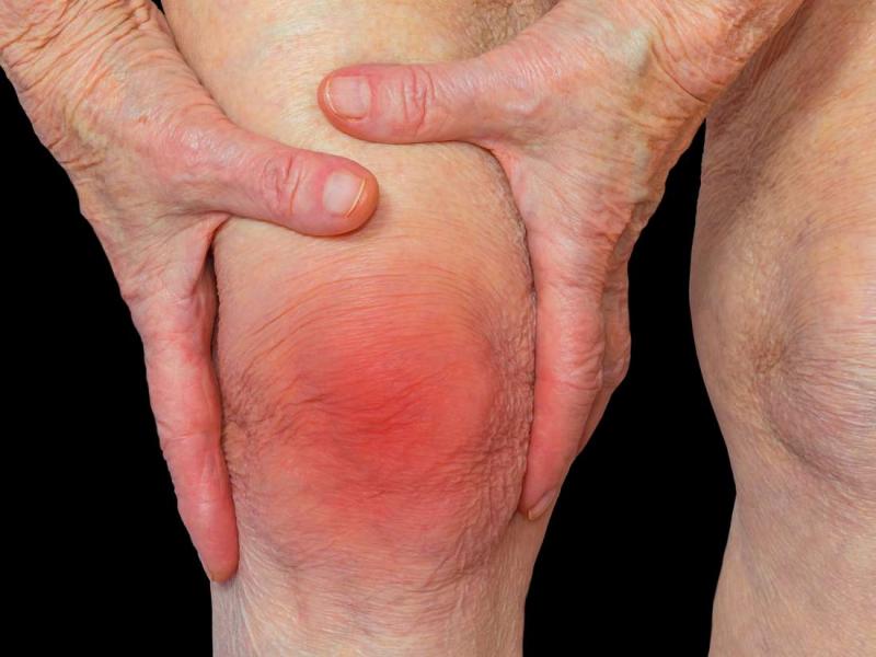 Суставная боль в колене при артрите