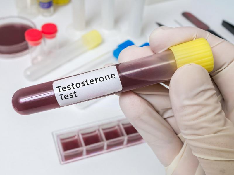 Testosteronun fonksiyonları, eksikliği ve takviyesi