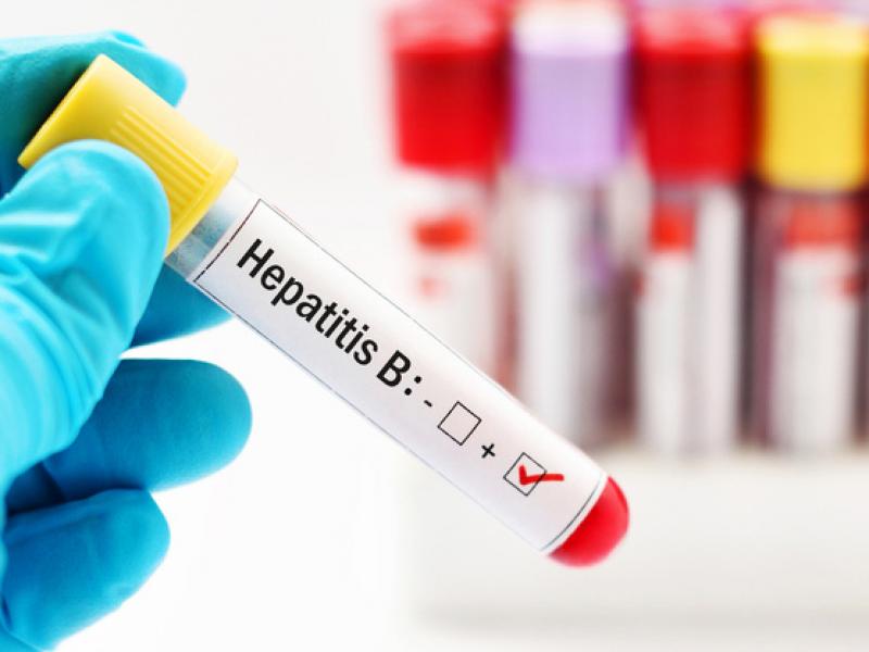Hepatit B Nedenleri, belirtileri ve tedavisi